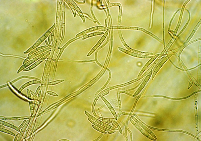 Механизм заражения пшеницы грибком Fusarium graminearum